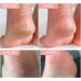 Cracked Heel Repair Cream Stick Foot Moisturizing Stick Foot Cream For Very Dry Feet Foot Cream For Calluses And Hard Skin Foot Moisturiser Callus Remover Soften For Feet Knees Hand - Buy Online on SooperMarket.com