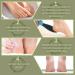 Double Sided Foot File Pedicure Foot Care Repair Tool Reusable Foot Scraper Hard Skin Remover Calluses Dead Skin Remover for Feet Foot Rasp File Foot Scrubber for Peel Wet Dry Cracked Feet Heel (Blue) - Buy Online on SooperMarket.com