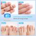 Incley Nail Fungus Cleaning Laser Device - Effective Blue Light Therapy for Toenails & Onychomycosis - Rechargeable Fungus Remover for Home Use - Buy Online on SooperMarket.com