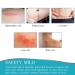 3Meters Silicone Scar Roll for C-Section Surgery Burn Keloid Acne - Drug-Free Professional Scar Sheets - Buy Online on SooperMarket.com
