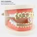 Gold Teeth Brace Set Hip Hop Punk Custom Fit Metal Teeth Decoration Jewelry Gold Teeth Grillz Oral Pain ReliefOral Care() - Buy Online on SooperMarket.com