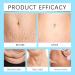 Skin Firming Cream Body Firming Cream for Loose Skin Skin Tightening Cream for Stomach Belly Firming Cream for Women&Men Skin Firming Lotion for Cellulite and Stretch Marks Lifting Moisturizing - Buy Online on SooperMarket.com