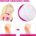 XAENA 3P Moisturizing Gel Heel Socks | Cracked Heel Repair Socks for Women | Toeless Gel Socks (White) - Shop Now! - Buy Online on SooperMarket.com