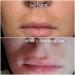 Dark Spot Corrector & Brightening Serum with Kojic Acid, Vitamin C, Salicylic Acid & More | Melasma Treatment Cream by Admire My Skin - Buy Online on SooperMarket.com