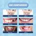 30 ml Tooth Repair Kit | Temporary Tooth Replacement & Moldable Thermal Fitting Beads for Missing Broken Teeth & Dentures - Buy Online on SooperMarket.com