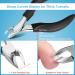 Orelex Nail Scissors - Professional Stainless Steel Nail Cutters for Thick Nails with Ergonomic Grip & Nail File | International Shipping Available - Buy Online on SooperMarket.com