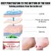 Regenerating Foot Cream for Firing (Rhagaden) Treatment - Heal Cracked Skin on Hands Elbows & Feet | International Shipping Available - Buy Online on SooperMarket.com