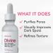 Niacinamide Serum 12% + Zinc 2% - Reduce Dark Spots & Minimize Pores | Dewy Youthful Glow - 1 fl oz - International Shipping - Buy Online on SooperMarket.com