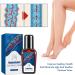 Varicose Vein Treatment Spray & Serum - 2 x 20ml for Spider Veins Relief | Effective Vein Care Cream - Buy Online on SooperMarket.com
