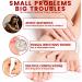 TBeautfave Fungal Nail Treatment Antifungal Nail Treatment Toe Nail Fungal Treatment Fungal Nail Treatment for Toenails Extra Strong Nail Repair and Strengthen Fix & Renew Damaged Broken Nails - Buy Online on SooperMarket.com