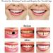 OTCPP Temporary Tooth Repair Kit - Teeth Veneers for Missing Tooth Support - Buy Online on SooperMarket.com