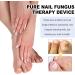 SenhE Fungus Laser Therapy Device Antibacterial Laser Equipment Light Therapy Device Fungal Nail Revolutionary High-Efficiency Light Therapy Device for Toenail Diseases  - Buy Online on SooperMarket.com