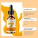 Vitamin C Serum for Face | 30ML Facial Skin Brightening Essence | Anti-Dark Spots & Brightening Serum | Facial Skin Brightening Essence for Skin Care - Buy Online on SooperMarket.com