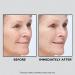 Peter Thomas Roth Instant FIRMx Face Tightener - Smooth Fine Lines, Deep Wrinkles & Pores - Buy Online on SooperMarket.com