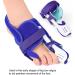 Bunion Toe Splint - Adjustable Strength, Pain-free Movement, Prevents Deviation, Hallux Valgus Support (Left) - Buy Online on SooperMarket.com