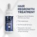 Head & Shoulders Scalp X Minoxidil for Men - Pack of 3 - 2 Fl Oz. - Buy Online on SooperMarket.com