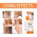 Vitamin C Armpit Whitening Cream Underarm Whitening Products For Body Whitening Skin Whitening Cream Skin Lightening Cream Melanin Removal For Underarms Armpit Knees Legs And Inner Thigh - Buy Online on SooperMarket.com