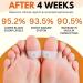 AcuHealth Sugar Control Toe Rings Therapeutic Magnetic Toe Ring Magnetic Therapy Ring Adjustable Pain Relief for Arthritis Blood Flow and Carpal Tunnel Lymphatic Drainage Therapeutic (Color : 5pa 5pairs - Buy Online on SooperMarket.com