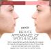 PURA DOR Organic Scar & Stretch Mark Treatment Oil | 1oz For Skin - Rosehip, Wheat Germ, Argan, Tamanu, Carrot, Rosemary, Lavender, Geranium, Patchouli, Sage - Buy Online on SooperMarket.com