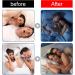 Mouth Tape for Sleeping - 120 PCS Medical-Grade Sleep-Closing Stickers for Nasal Breathing, Snoring, Dry Mouth - Orthodontic Aid - Buy Online on SooperMarket.com