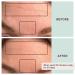 Buy Dermaclara Silicone Face Patches for Wrinkles & Fine Lines | Reusable Anti-Wrinkle Forehead & Under Eye Patches - Pregnancy Safe Skincare - Buy Online on SooperMarket.com