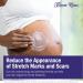 Bloom Krans Stretch Mark Cream for Pregnancy | Moisturizing Stretch Mark Remover & Prevention Lotion for Pregnant Belly & Postpartum Essentials - Buy Online on SooperMarket.com