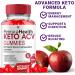 Perma Health Gummies PermaHealth Keto ACV Gummies Perma Health Apple Cider Vinegar Weight Management Support Supplement Perma Health Canada Max Strength Health Support Gummy Formula (60 Gummies) - Buy Online on SooperMarket.com