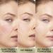 L'Or al Paris Redness Eraser Primer - Long-Lasting Make-Up Base Conceals Redness 24-Hour Wear - 30ml - Buy Online on SooperMarket.com
