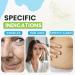 Acmella extract 5 ml - A concentrated firming and wrinkle smoothing active ingredient - Buy Online on SooperMarket.com