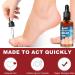 Top Nail Fungus Treatment: German ToenailPlus Kaluofan & More Effective Anti Paronychia Relief & Nail Care - Buy Online on SooperMarket.com