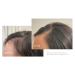Virtue Flourish 100% Drug-Free Hair Growth Regimen - 3 Month Kit for Healthy Hair | International Shipping Available - Buy Online on SooperMarket.com