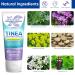 Tinea Versicolor Natural Skin Cream - Effective Treatment for All Skin Types - Buy Online on SooperMarket.com