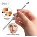 Blackhead Remover Comedone Squeezer Set Blackhead Remover Pore Cleanser Facial Cleansing Pimples Acne Whiteheads Blackhead Remover Kit with Box of 4 - Buy Online on SooperMarket.com