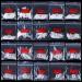 AORAEM Stiletto Nail Tips - 1000Pcs Acrylic False Nails Set with Bag (Short Clear+Natural) - Buy Online on SooperMarket.com