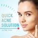 Hydrocolloid Acne Patches (120 Pack) with Tea Tree Oil - Pimple Stickers for Healing Acne - Zit Patch Treatment - Buy Online on SooperMarket.com