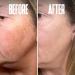 Dark Spot Corrector Serum - Remove Stubborn Dark Spots with Kojic Acid & Alpha Arbutin | Brightening Discoloration Remover for Face - Buy Online on SooperMarket.com