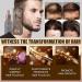 Trendyfave Hair Growth Serum Hair Serum for Hair Growth Ginger Hair Growth Serum Anti Hair Loss Essence for Fast Hair Growth Nourishing Repair Damaged Hair Stimulates Hair Growth Serum for Women Men - Buy Online on SooperMarket.com