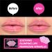 SooAE My Collagen Hydrogel Lip Patch - 12 Count Moisturizing Anti-Aging Lip Mask for Youthful Lips - Buy Online on SooperMarket.com