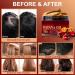 Unrefined Batana Oil for Hair Growth | Organic Nourishing Moisturizer | Repair Damaged Hair & Prevent Hair Loss | 4.0 Fl. Oz - Buy Online on SooperMarket.com