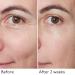By Terry Hyaluronic Global Face Serum - Reduces Wrinkles & Fine Lines Vegan Fragrance-Free All Skin Types - 1.1 fl oz | International Shipping Available - Buy Online on SooperMarket.com