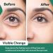 Vivo Per Lei Vitamin C Eye Cream - Anti-Aging Retinol & Peptide Formula for Puffiness Wrinkles & Dark Circles - 1.7 Fl. Oz - Buy Online on SooperMarket.com