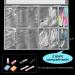 Stiletto Clear Nail Tips 500PCS Full Cover Acrylic Nails with Case for Nails Salon - Buy Online on SooperMarket.com