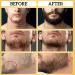 Best Beard Oil for Men | 30ml Organic Growth & Care | Soften & Moisturize Your Beard - Buy Online on SooperMarket.com