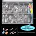 Almond Shaped Nail Tips 500Pcs Clear Acrylic Medium Nails Full Cover with Case for DIY Nail Art 10 Sizes - Buy Online on SooperMarket.com