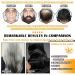 Black Hair Dye Shampoo - 3 in 1 Natural Hair Color & Grey Coverage | Long Lasting Instant Dye for Men & Women - Buy Online on SooperMarket.com