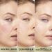 L'Or al Paris Redness Eraser Primer - Long-Lasting Makeup Conceals Redness 24-Hour Hold Advanced DERM Primer (30 ml 2-Pack) - International Shipping Available - Buy Online on SooperMarket.com