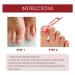 Top Nail Fungus Treatment: German ToenailPlus Kaluofan & More Effective Anti Paronychia Relief & Nail Care - Buy Online on SooperMarket.com