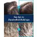 Esthetic House CP-1 Scalp Scaler (250ml): Deep Cleansing Scalp Scrub for Scalp Relief - Buy Online on SooperMarket.com