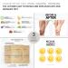DERMAVITAMINS Advanced Foot Pad Gift Pack | 6 Treatments for Healthy Feet | Shop Internationally - Buy Online on SooperMarket.com