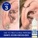 BodyJ4You Piercing Aftercare Spray | Keloid Bump Removal & Cleaner for Earring Holes | Natural Saline Wound Wash | Pierced Ears & Nose Cleaning Kit - Buy Online on SooperMarket.com